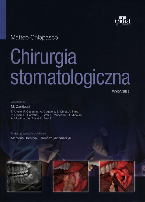 

Chirurgia stomatologiczna M. Chiapasco