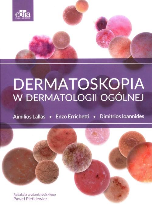 

Dermatoskopia w dermatologii ogólnej