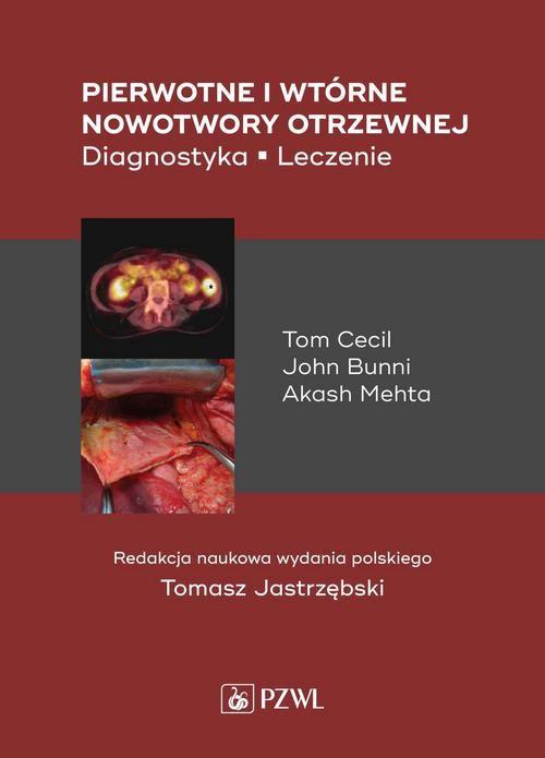 

Pierwotne i wtórne nowotwory otrzewnej