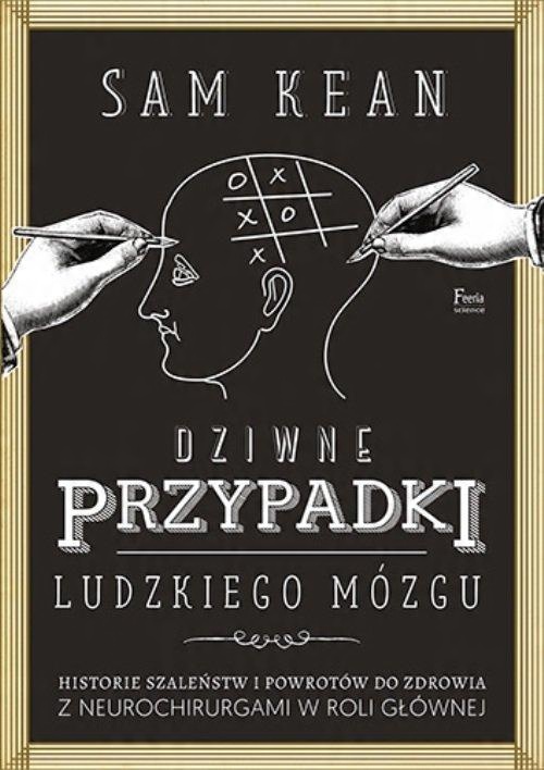 

Dziwne przypadki ludzkiego mózgu Sean Kean