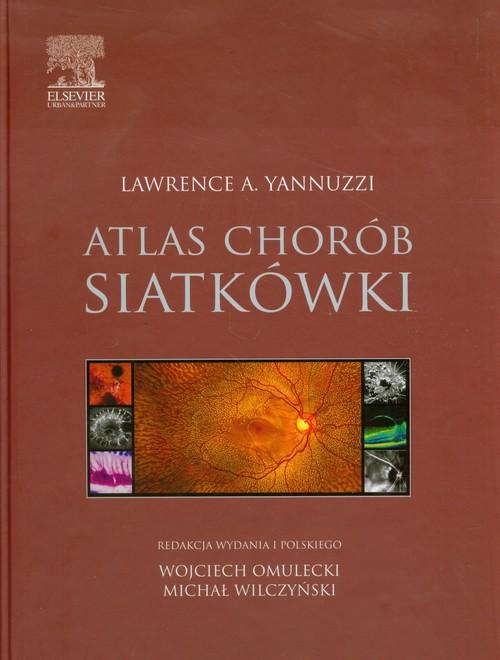 

Atlas chorób siatkówki Lawrence A. Yannuzzi