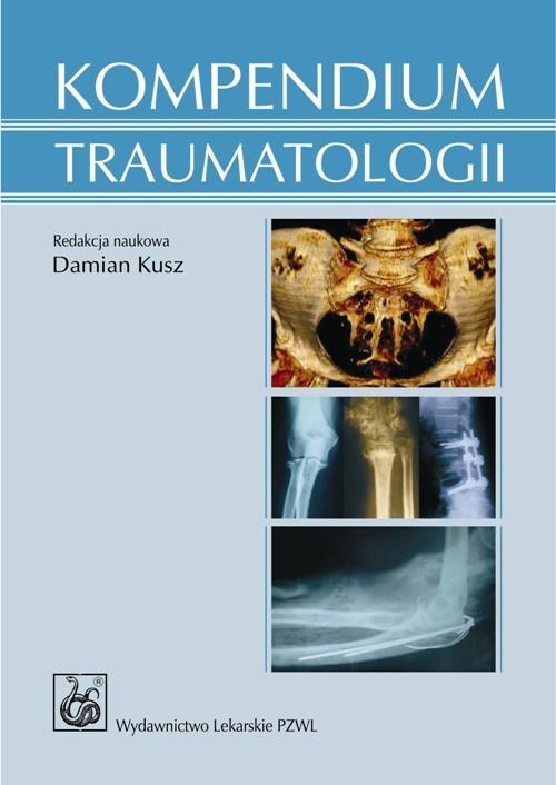 

Kompendium traumatologii