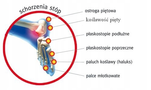PODPIĘTKA ORT MAZBIT MEMO OSTROG LUX MT367 ROZ 4 Rodzaj podpiętki
