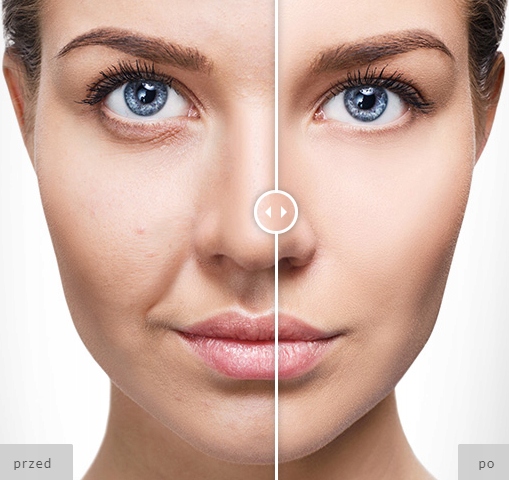 KOLAGEN MORSKI DO PICIA - SPOSÓB NA ZMARSZCZKI !! Marka inna marka