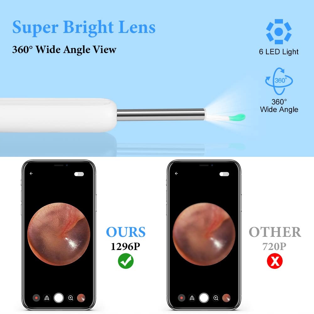 ACWOO Kamera Do Czyszczenia Uszu IP67 Wodoodporna Z WiFi i 6 LED — miniatura 4