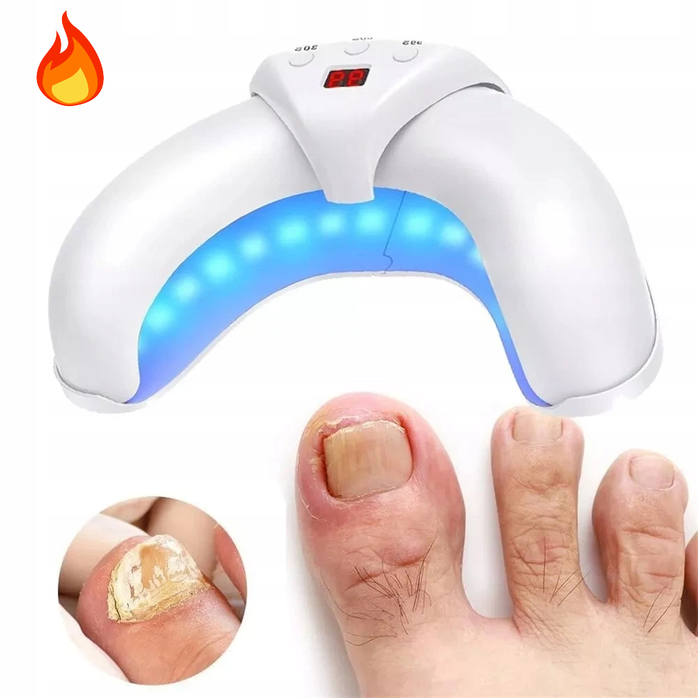 Laserové Zařízení Pro Léčbu Mykózy Nehtů, Lehké, Přenosné Na Cesty