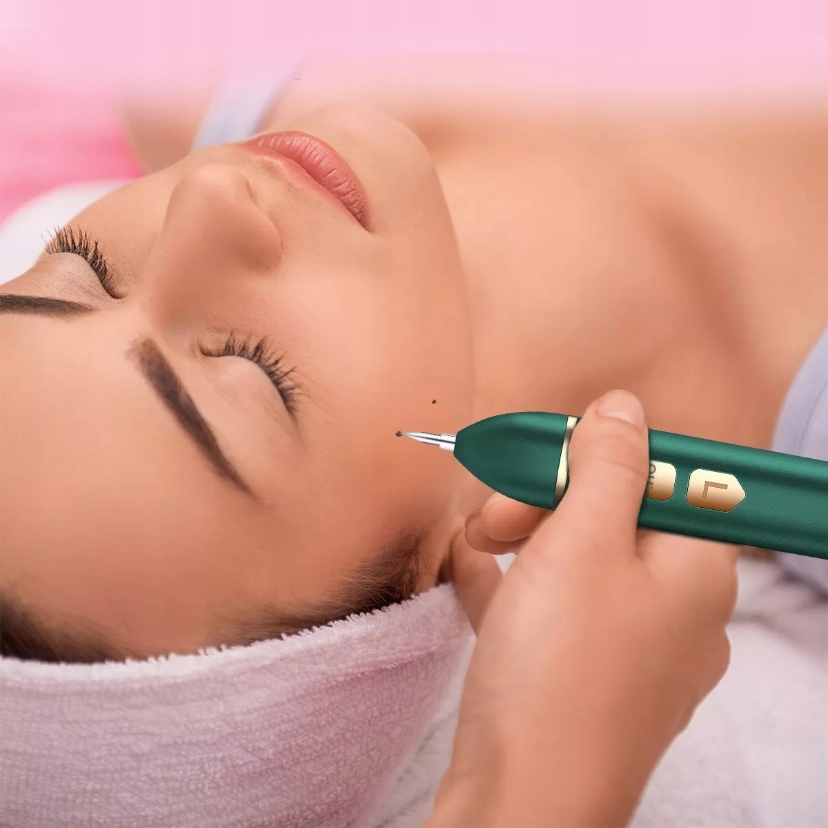 Plazma Pen Laser Plasma zapisuje Kretów Tatuaży Rodzaj laser IPL