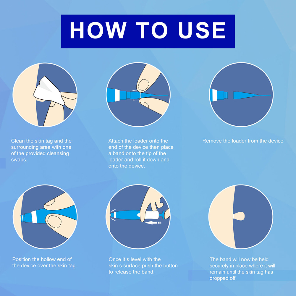 2 IN 1 Auto Skin Tag Remover Kit Micro Skin Tag Pojemność 6 ml