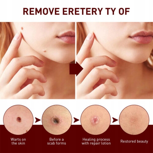 Szybko usuń etykietę z esencji ze skóry 3 ml Rodzaj płyn