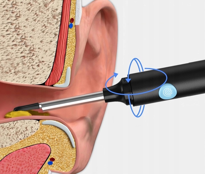 SMART OTOSKOP KAMERA CZYSZCZENIE USZU USUWANIA WOSKOWINY WIFI HD ENDOSKOP Kolor dominujący czarny