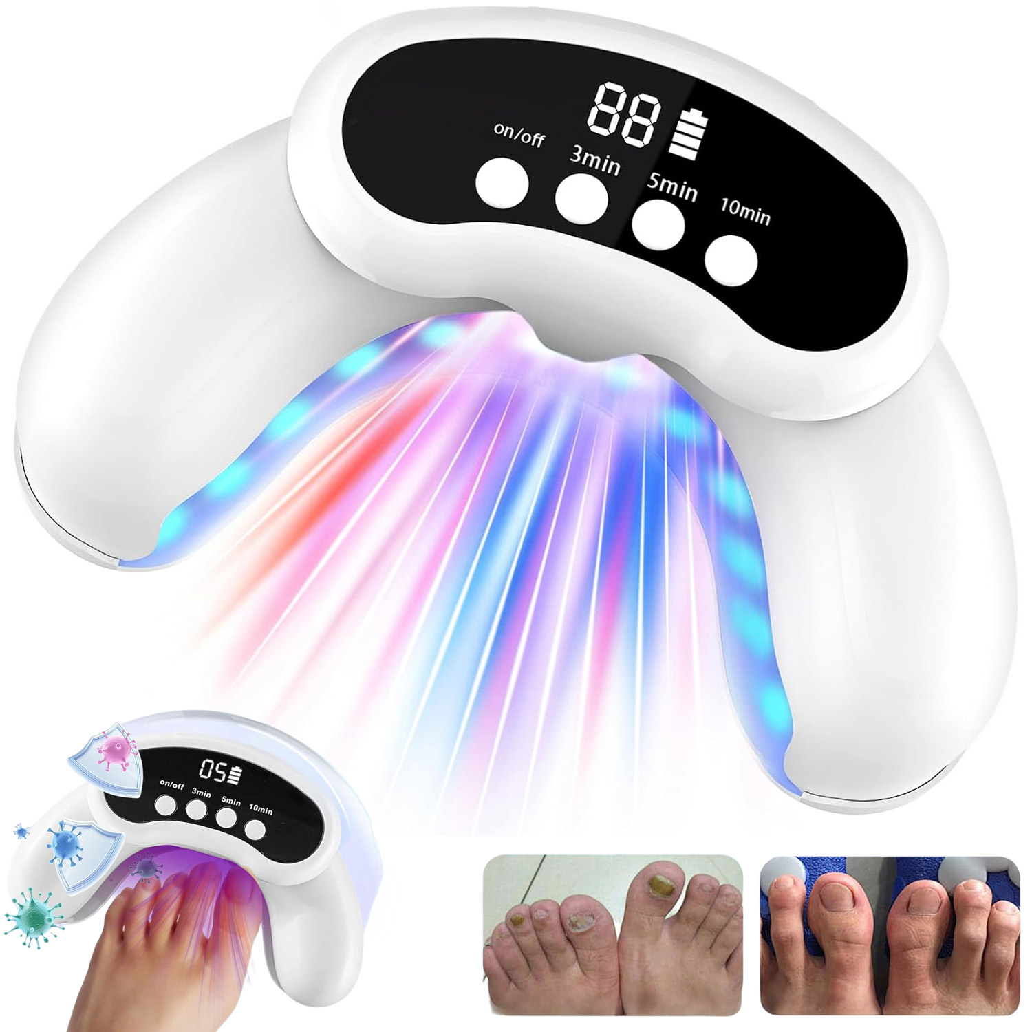 Laserové Zařízení Na Mykózu Nehtů, Účinné, Bezbolestné Uv 30 Led