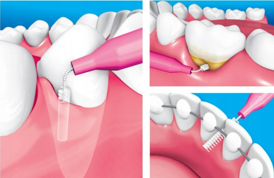 PIKSTERS Szczoteczki międzyzębowe R0 0,36mm 10szt EAN (GTIN) 9336628000001