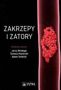 Zakrzepy I Zatory Tomasz Pasierski