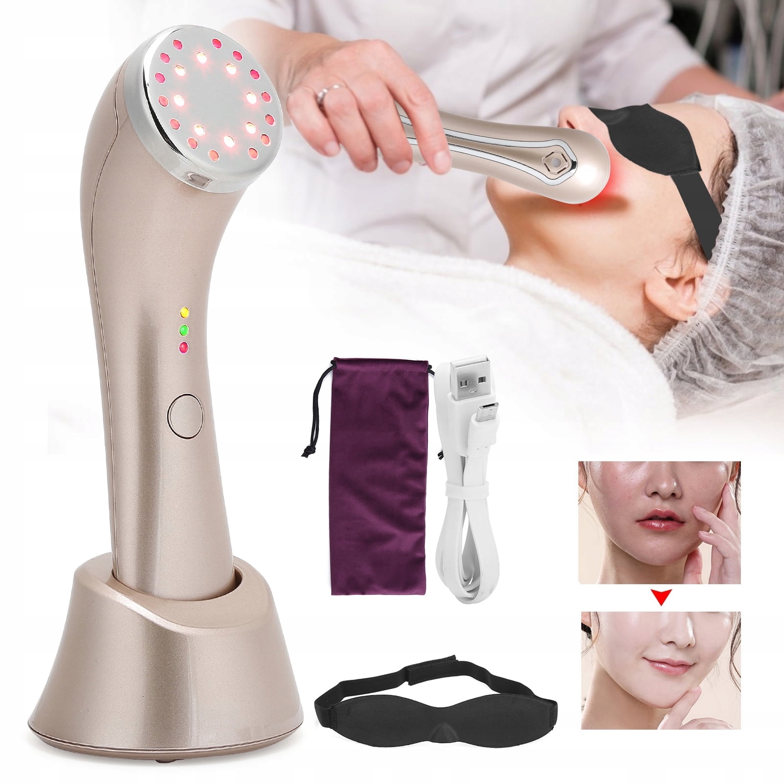 Mezoterapie 3 V 1, Terapie Liftingovým Světlem