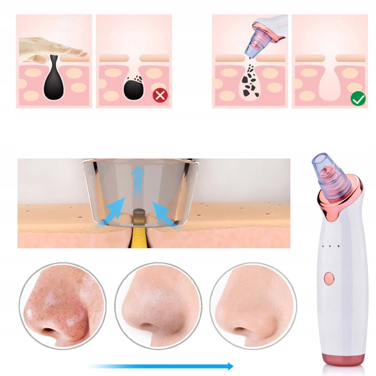 ODKURZACZ WĄGRÓW 12w1 Mikrodermabrazja Diamentowa + maseczka pilaten black Zasilanie akumulatorowe