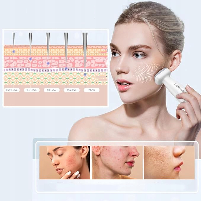 DERMA STAMP MICRO IGŁA Z REGULOWANĄ IGŁĄ 0MM-2.0MM PROFESJONALNA Zasilanie brak