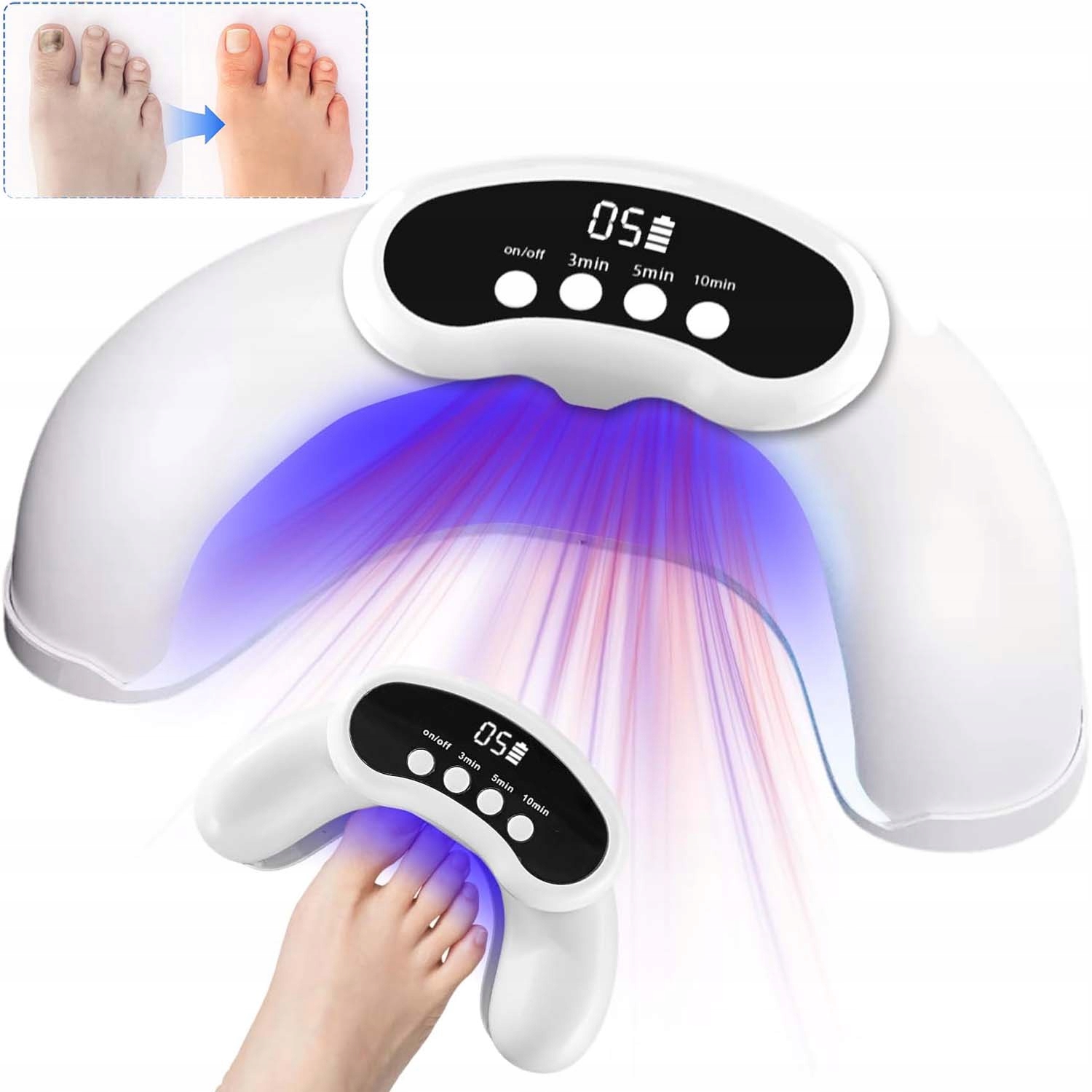 Uv Lampa Pro Léčbu Mykózy Nehtů Domácí Přenosná Malá 905 Nm 470 Nm