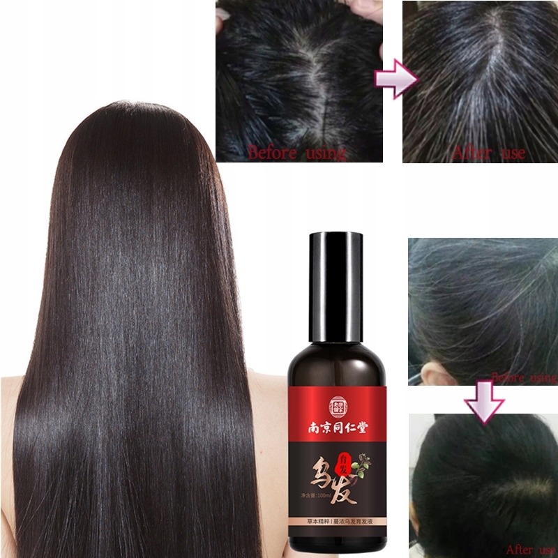 Spray Polygonum Multiflorum Aby Zapobiec Pęknięciu Opakowanie atomizer