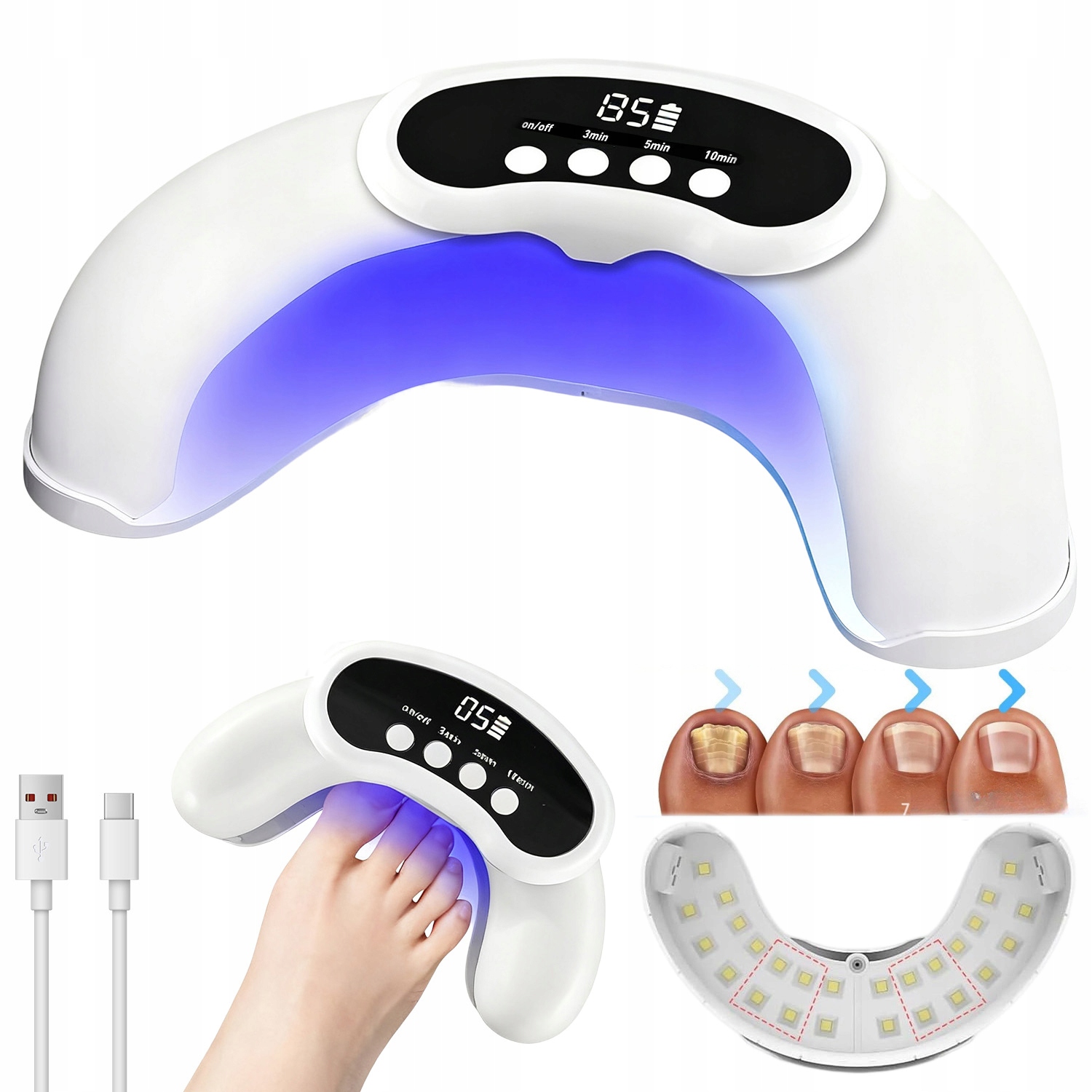 Protiplísňové Laserové Zařízení Pro Léčbu Mykózy Nehtů Na Nohou