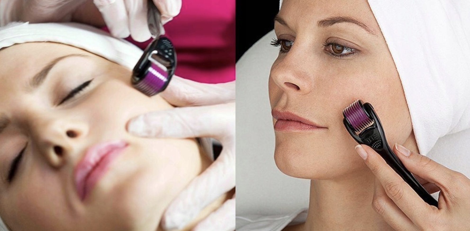 DERMA ROLLER ŁYSIENIE GĘSTA BRODA MEZOTERAPI WŁOSY Model DRS