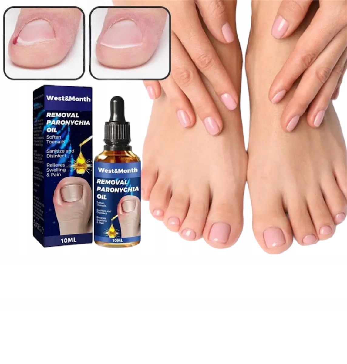 PŁYN NA WRASTAJĄCE PAZNOKCIE NA BÓL PAZNOKCIA EAN (GTIN) 5070000938691