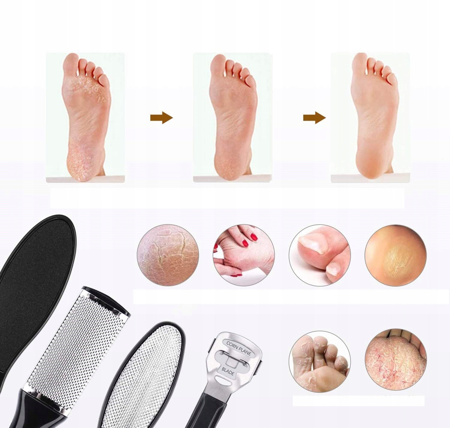 Sada Pro Odstranění Zrohovatělé Kůže