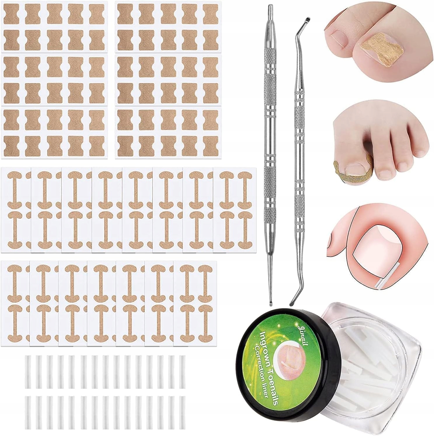 Sada na zarostlé nehty, náplasti, příslušenství