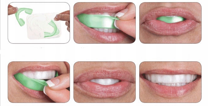 OPALESCENCE GO 1*GOTOWE NAKŁADKI_ŻEL DO WYBIELANIA Rodzaj nakładki wybielające