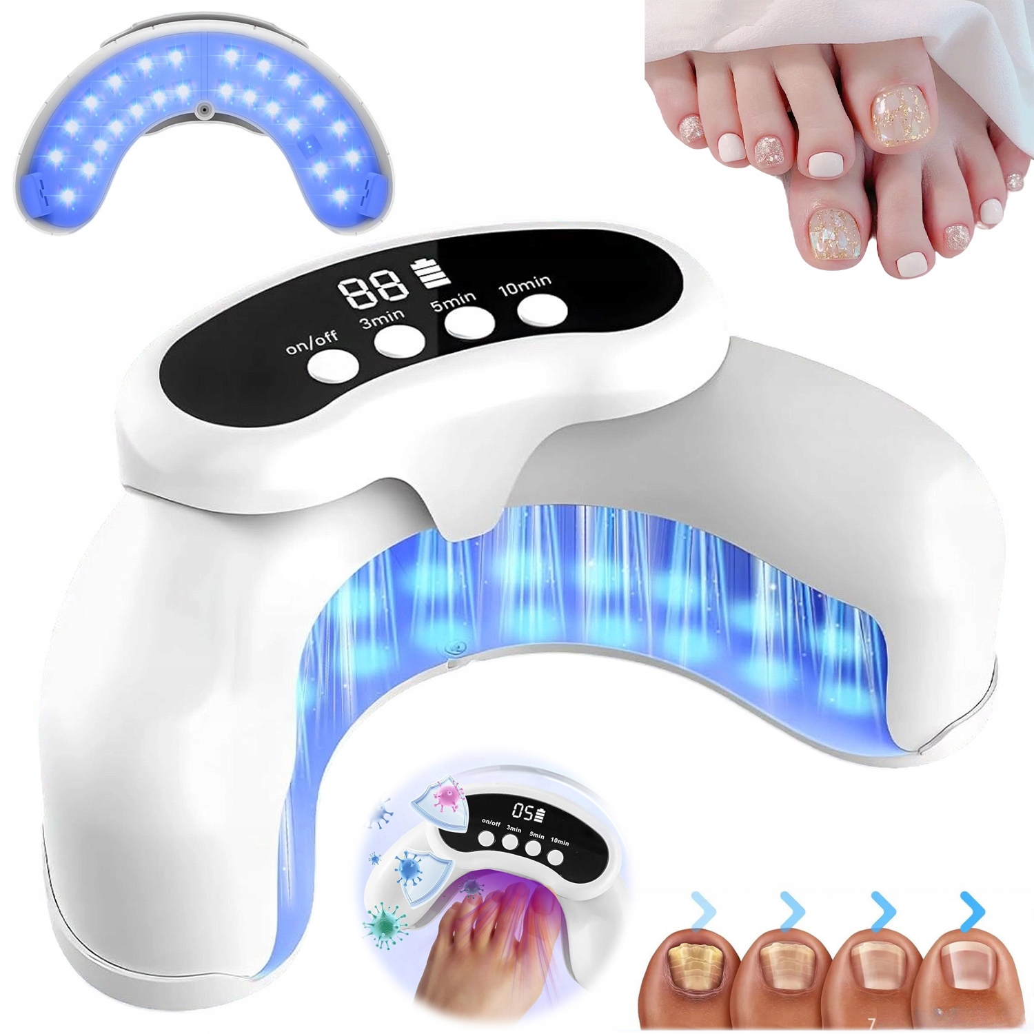 Laserové Zařízení Pro Léčbu Mykózy Nehtů S 30 Led Diodami, Přenosné