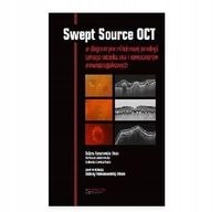 

Swept Source Oct. W diagnostyce patologii tylnego