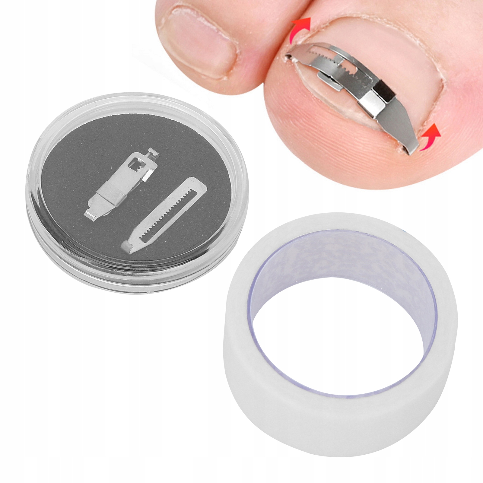 Klamry na wrastające paznokcie Korektor Rodzaj zestaw