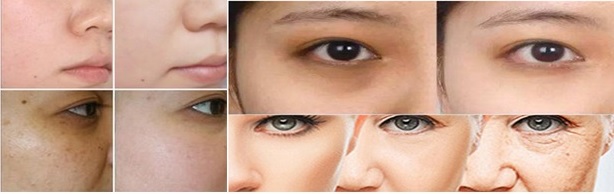 URZĄDZENIE USUWANIA ZMARSZCZEK FALE RF MEZOTERAPIA Model MEZO