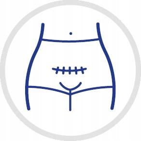 CANPOL MAJTKI POPORODOWE WIELORAZOWE L/XL 2szt. Kolor biały