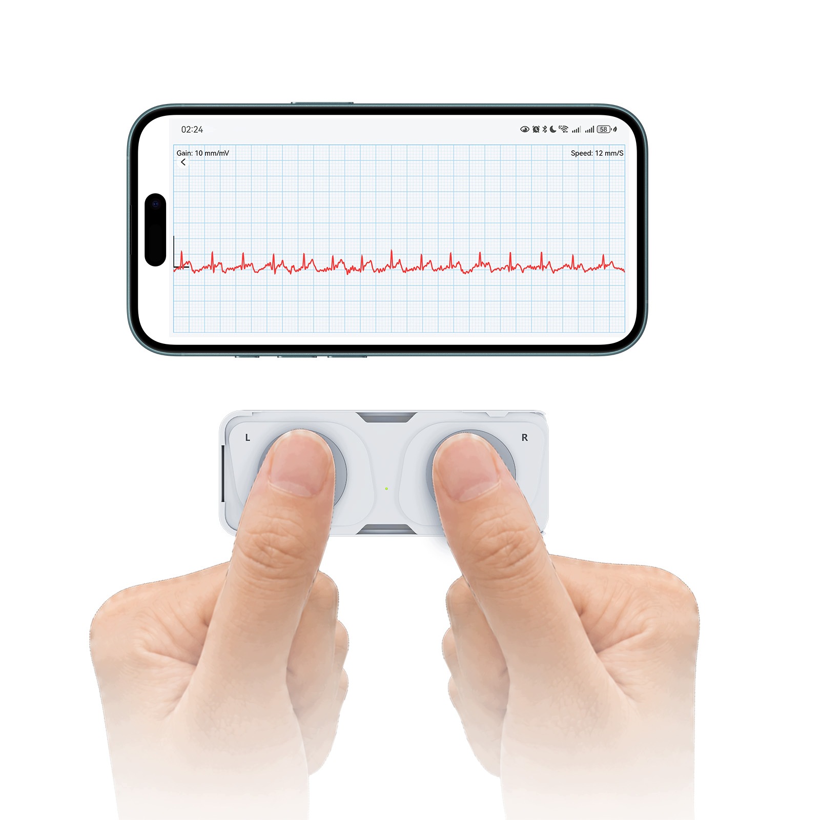 Personalne Ekg urządzenie mobilne-Domowy Arytmia Tachyka bradyka AppRaporty