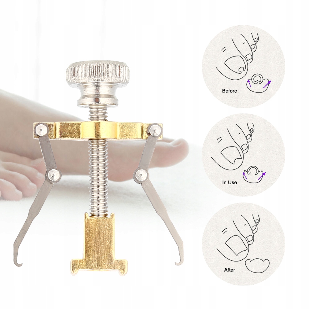 Sonda podologiczna do wrastających paznokci dłut Skład zestawu cążki