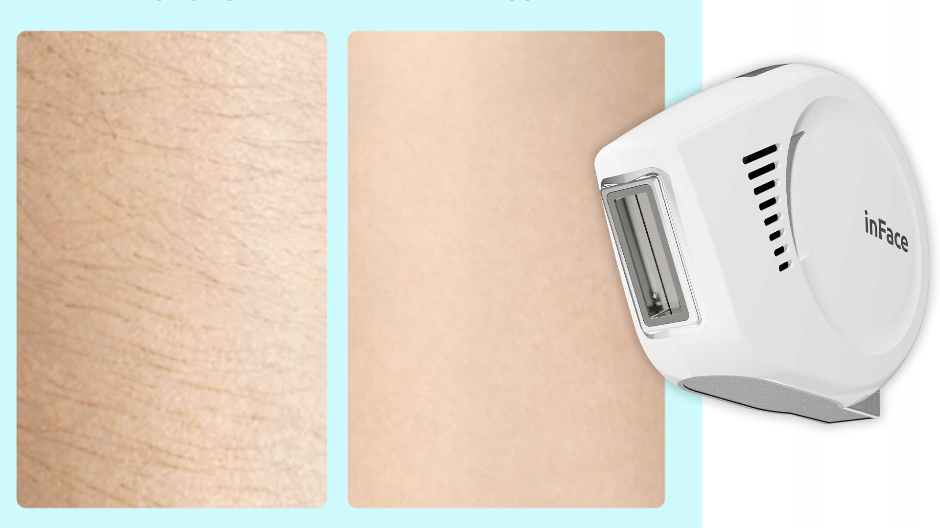 inFace DEPILATOR IPL BEZBOLESNY BEZPIECZNY ZH-01F do użytku domowego Funkcje filtr UV tryb seryjny lampy błyskowej