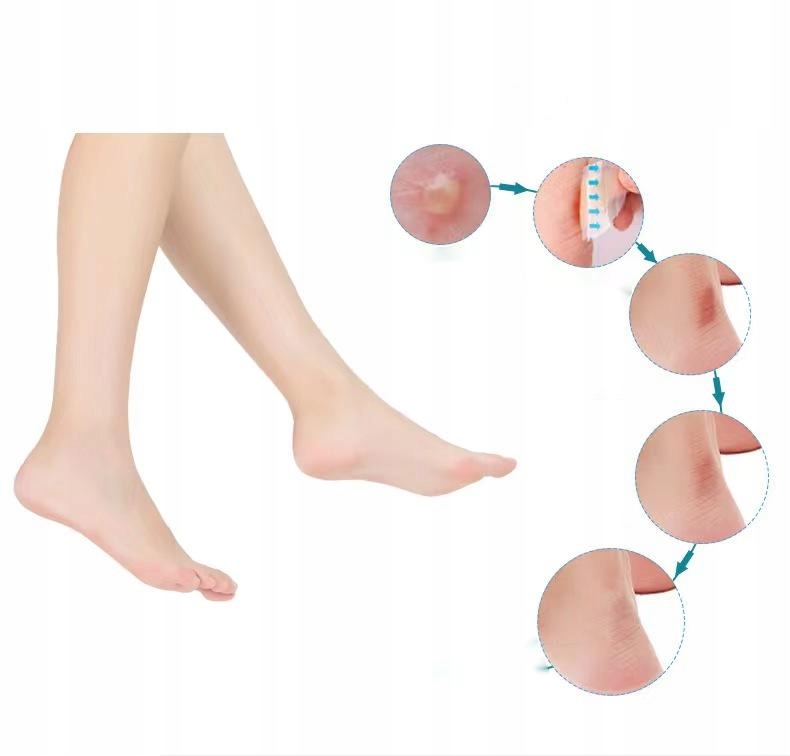 TYNK HYDROKOLOIDOWY 3X6 NA PĘCHERZE OTARCIA ODCISKI ZMNIEJSZAJĄCY TARCIE EAN (GTIN) 748664638633