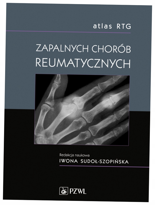 Atlas Rtg zapalnych chorób reumatycznych