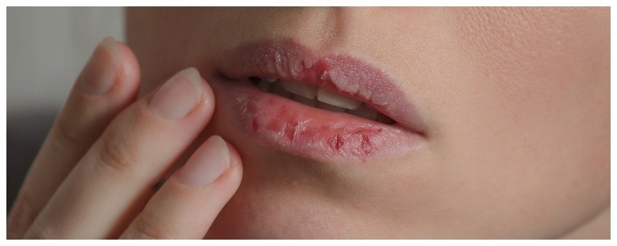 Biowosk do ust ,,Szybka pomoc" 15 ml Marka DNC