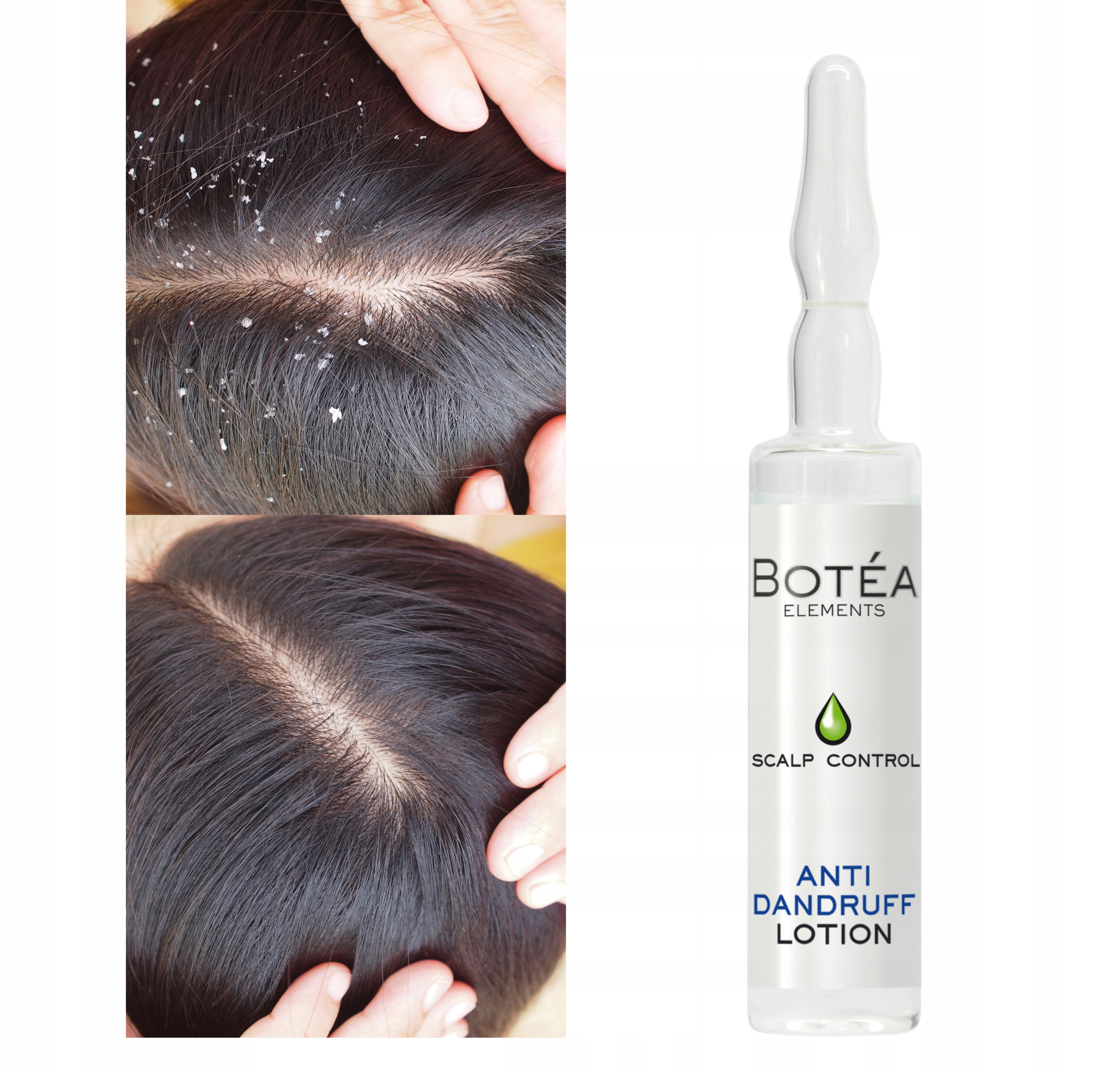 FLUID LOTION PRZECIWŁUPIEŻOWY DO WŁOSÓW 10ml