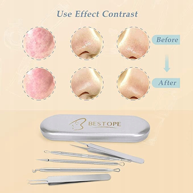 BESTOPE - ZESTAW DO USUWANIA WĄGRÓW I ZASKURNIKÓW EAN (GTIN) 600977374526