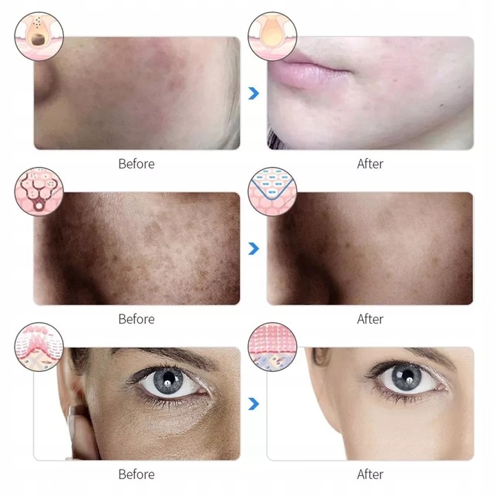 Maska LED na twarz 7 kolorów LED terapia FOTONOWA ŚWIATŁEM Marka inna marka