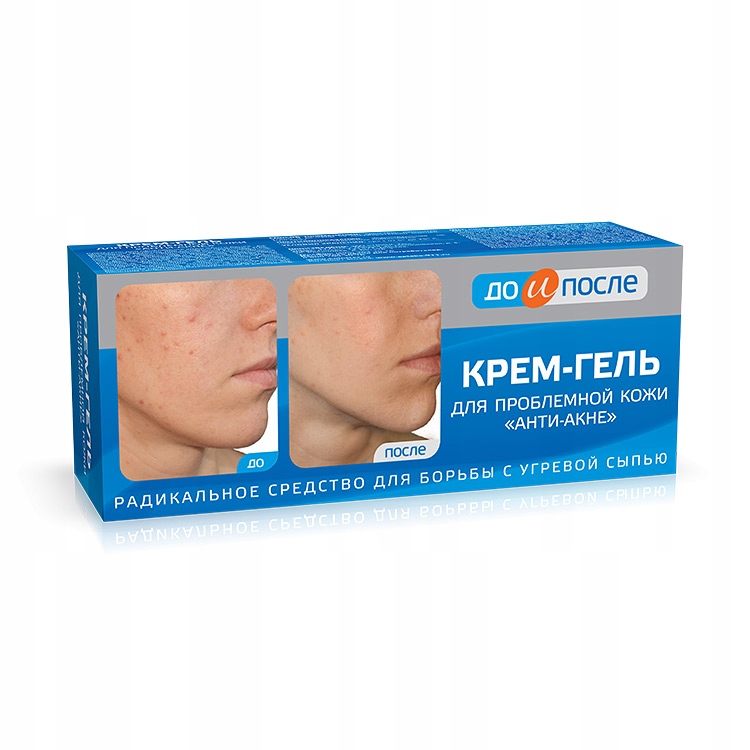 

Krem na trądzik 50 ml
