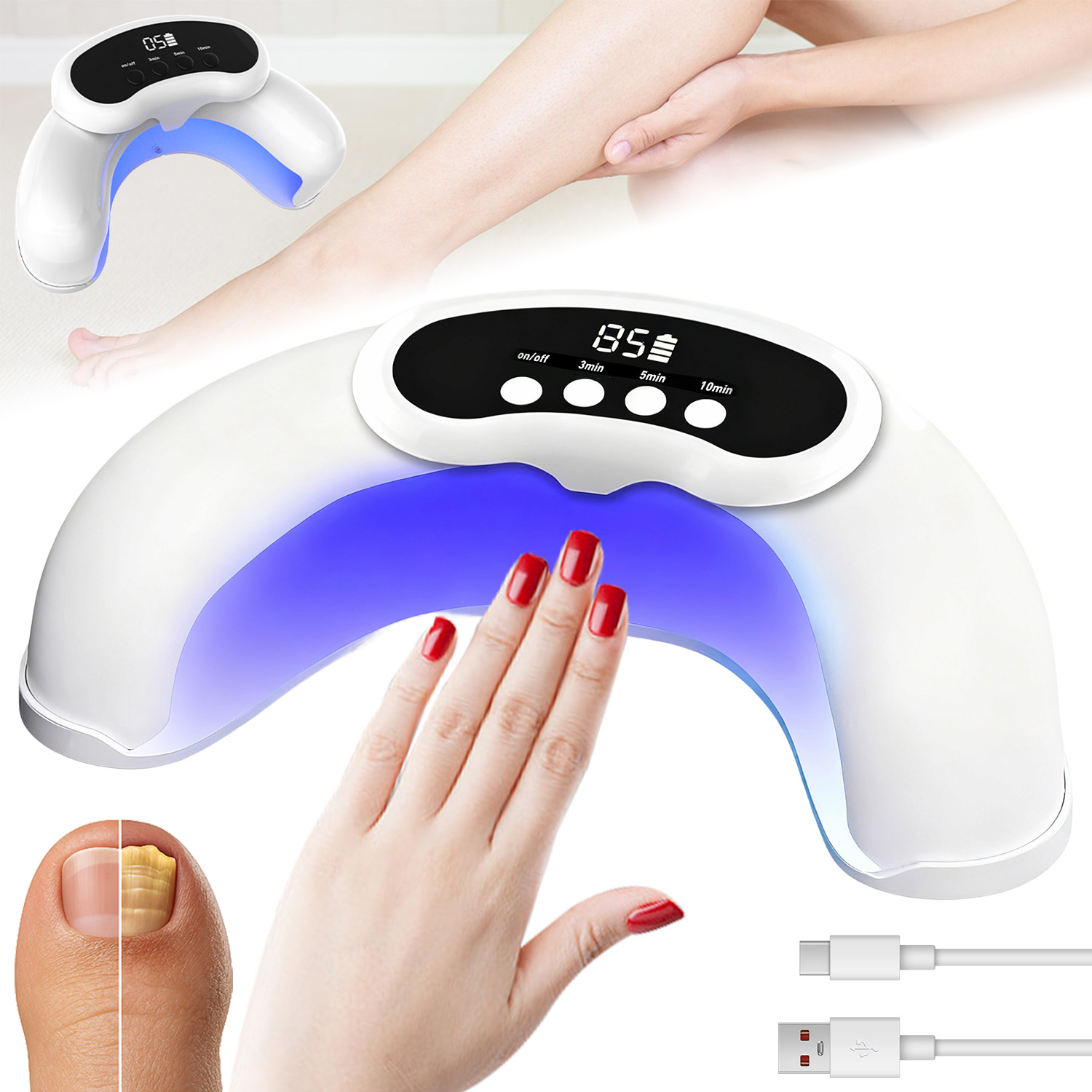 Protiplísňové Laserové Zařízení, Mykóza Nehtů, Lampa Na Nehty