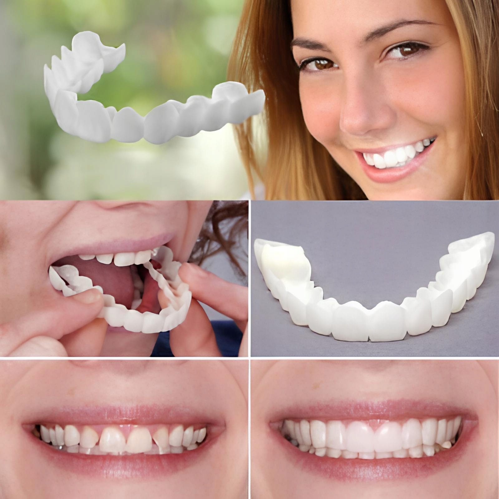 Licówki dentystyczne Snap on Smile nakładki góra i dół