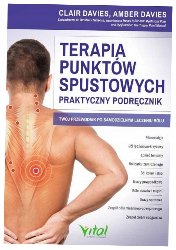 Terapia punktów spustowych. Praktyczny podręcznik