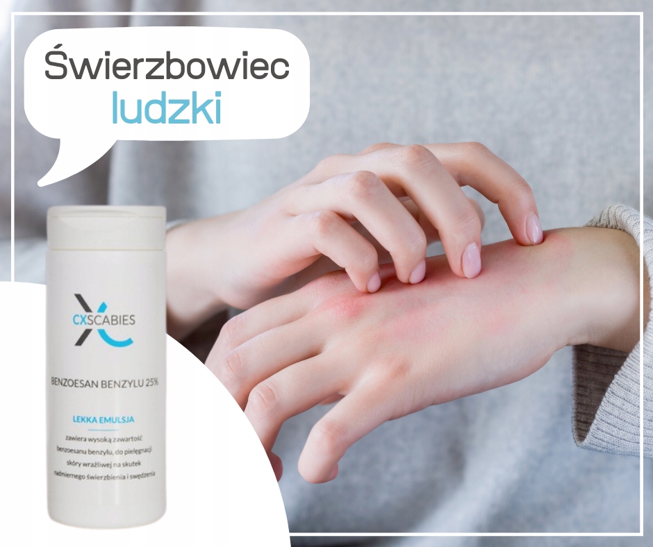 

Cxscabies benzoesan benzylu 25% na świerzb