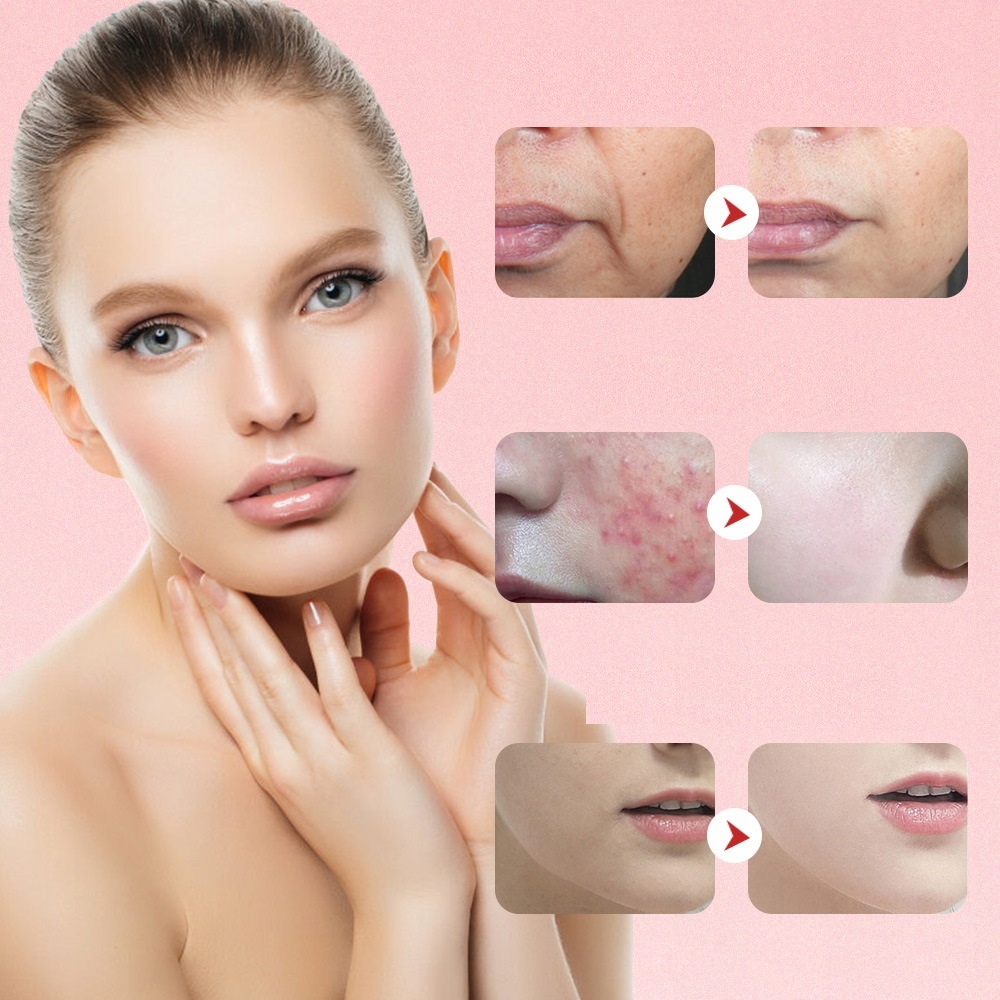 MEZOTERAPIA BEZIGŁOWA MASAŻER 7w1 EMS DO TWARZY LIFTING URZĄDZENIE DO MASAŻ Typ stempel