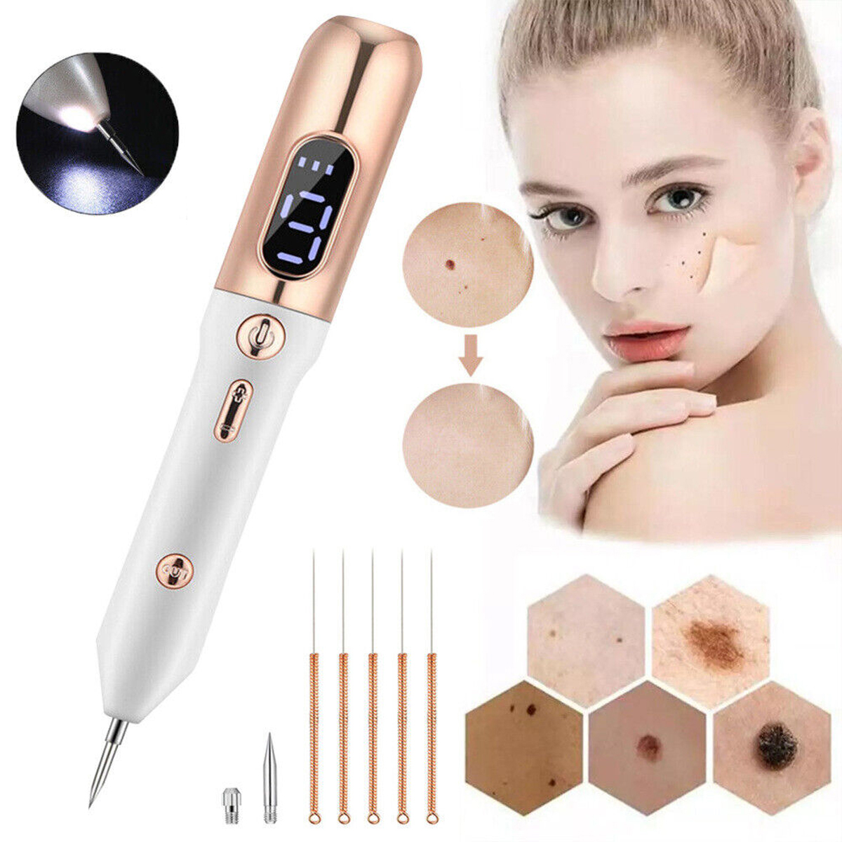 Laserové Pero Na Odstraňování Plazmových Znamének Pro Odstraňování Bradavic, Pepř