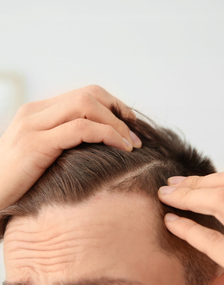 Lotion przeciw wypadaniu włosów dla mężczyzn Seboradin MEN 200 ml Rodzaj wcierka